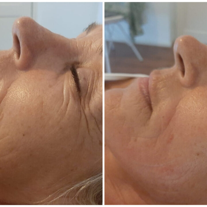 Show your best results! Het resultaat van Laura Brink van Beauty Huis
