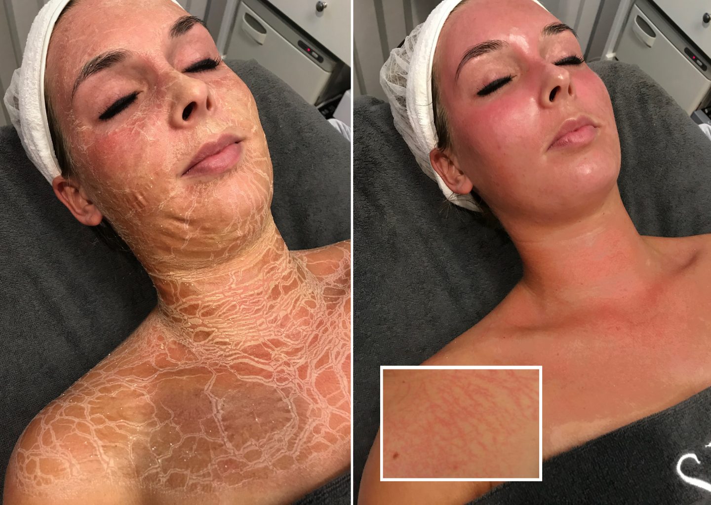 BioPulse Therapie: probeer het gratis uit!