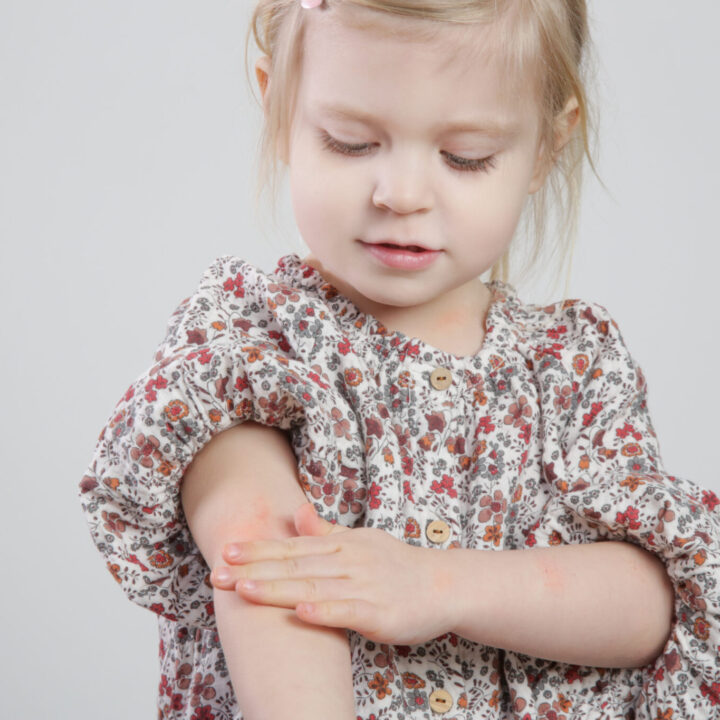 Nieuw initiatief leert basisschool kinderen over hun huid