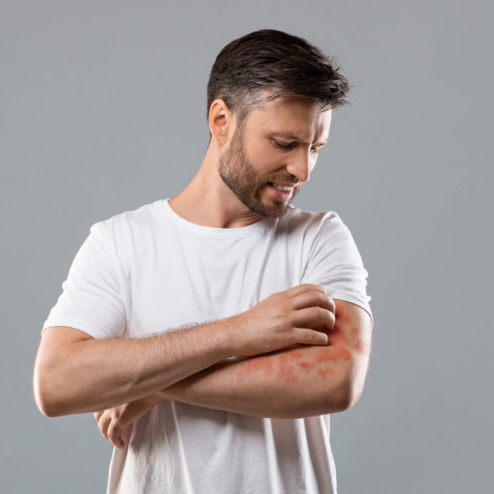 Psoriasis onder de aandacht