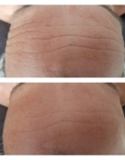 Opleiding Orthomoleculair Schoonheidsspecialist januari van start