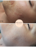 VIDEO: Masterclass Charlotte Meindersma – Charlottes Law & Fine Prints