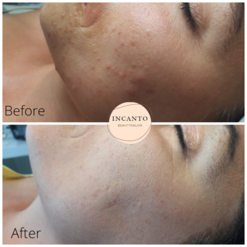 Show your best results by Vanessa Spitale – Incanto Beautysalon