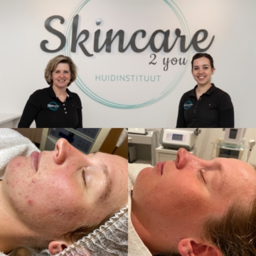 Show your best results by Skincare 2 you met SUPERBOOST