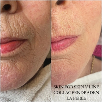 Show your best results by Janneke Jolink van La Perle