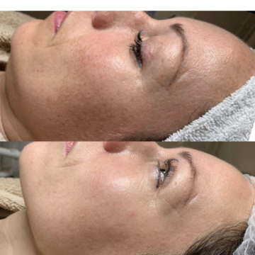 Show your best results by Renée de Jong van Beautyinstituut Mariëlle