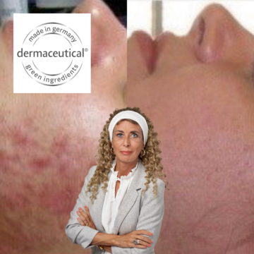 Show your best results by Dora & dermaceutical