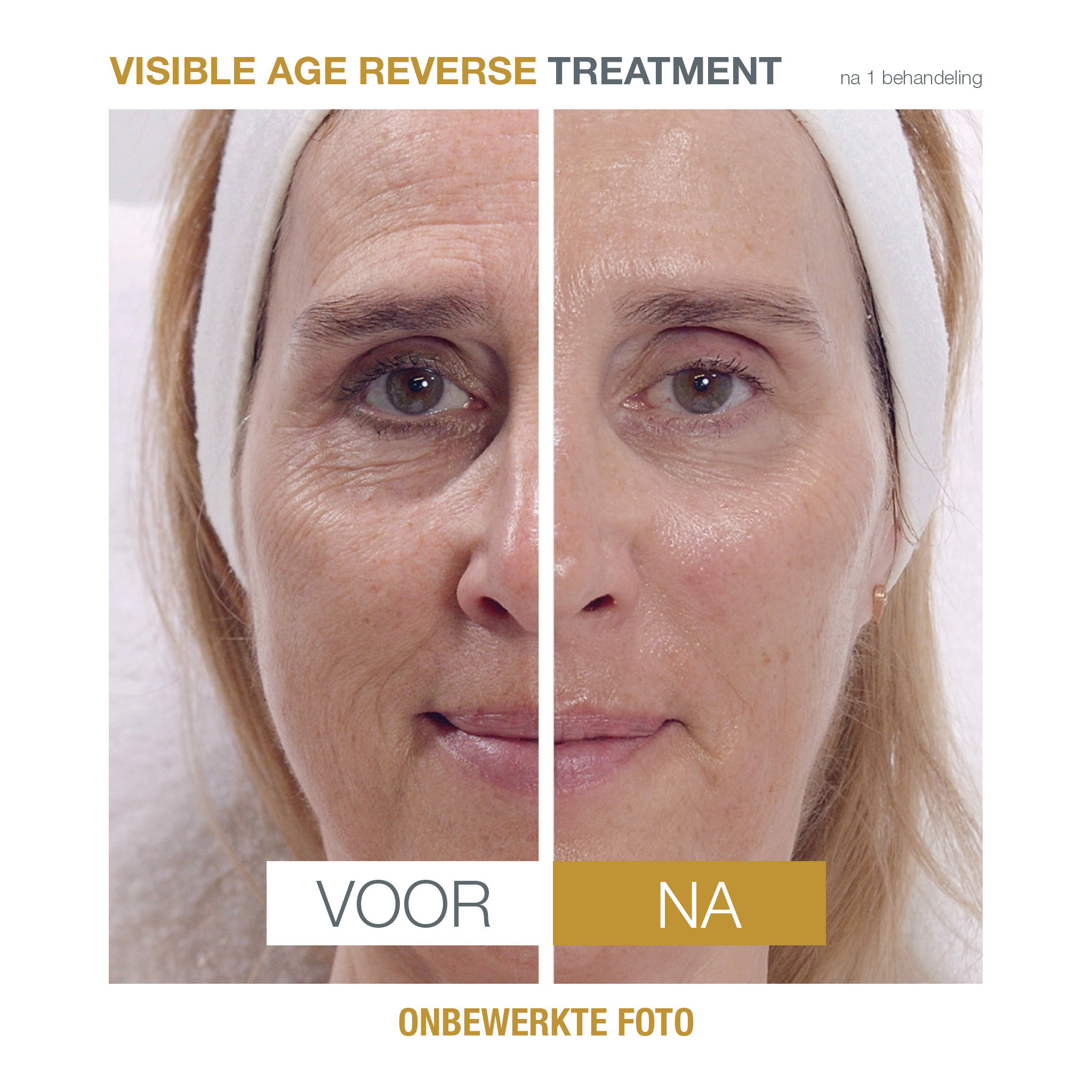 Direct zichtbare resultaten in slechts 30 minuten met de VAR