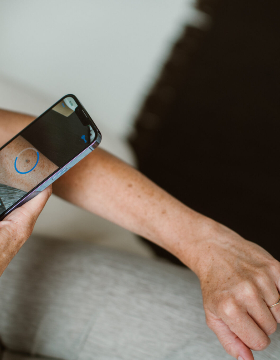 SkinVision-app ontvangt officiële medische EU-goedkeuring voor huidkankercontrole