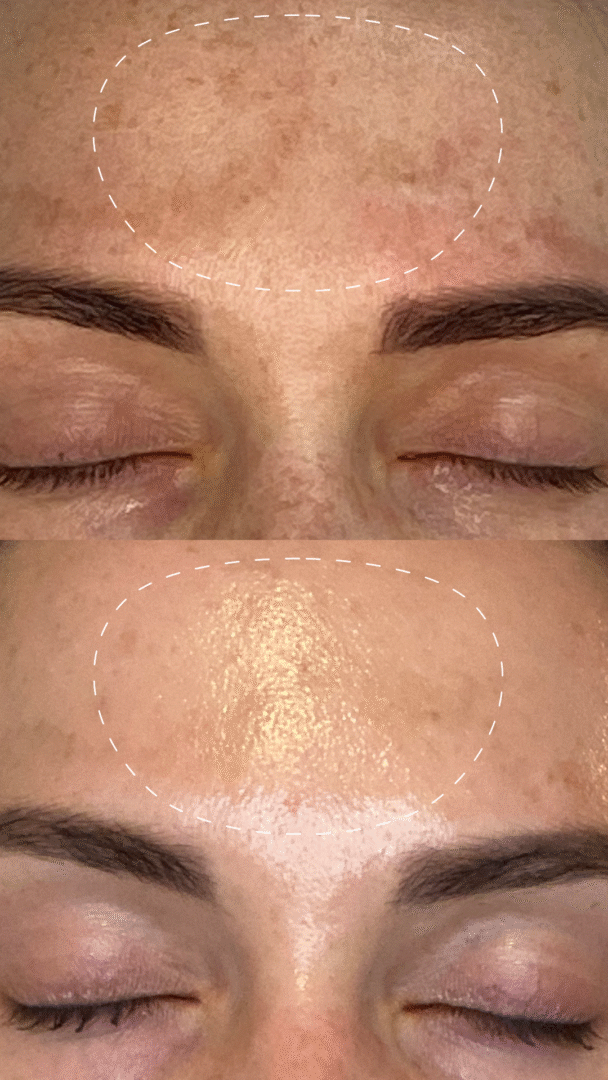 Dermalogica Melano Pro Peel System

