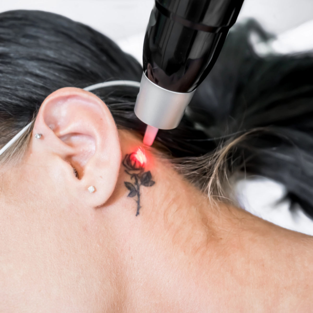 Brancheorganisaties zetten grenzen bij tattoo removal