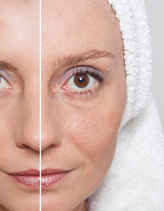 Is huidveroudering in de overgang aantoonbaar te verbeteren?