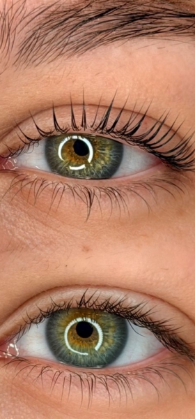 De Koreaanse wimperlift