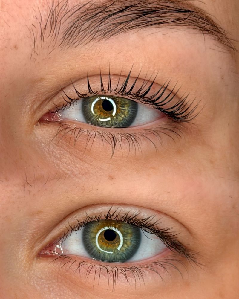 De Koreaanse wimperlift