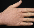 Esse introduceert Menopause Massage